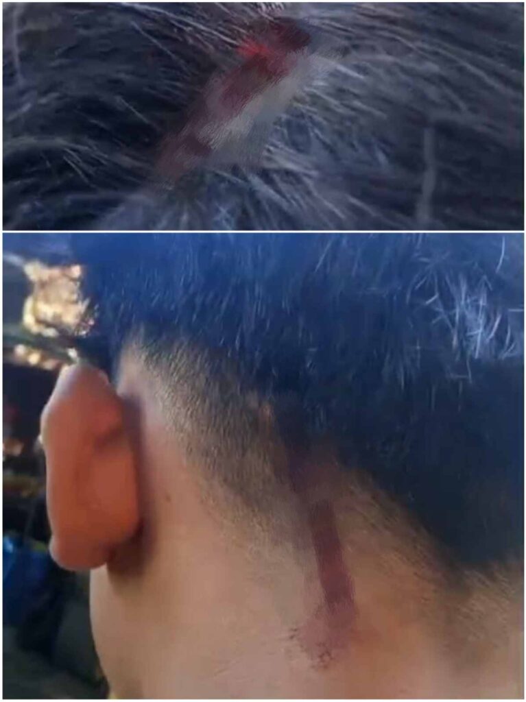 korban penganiayaan2